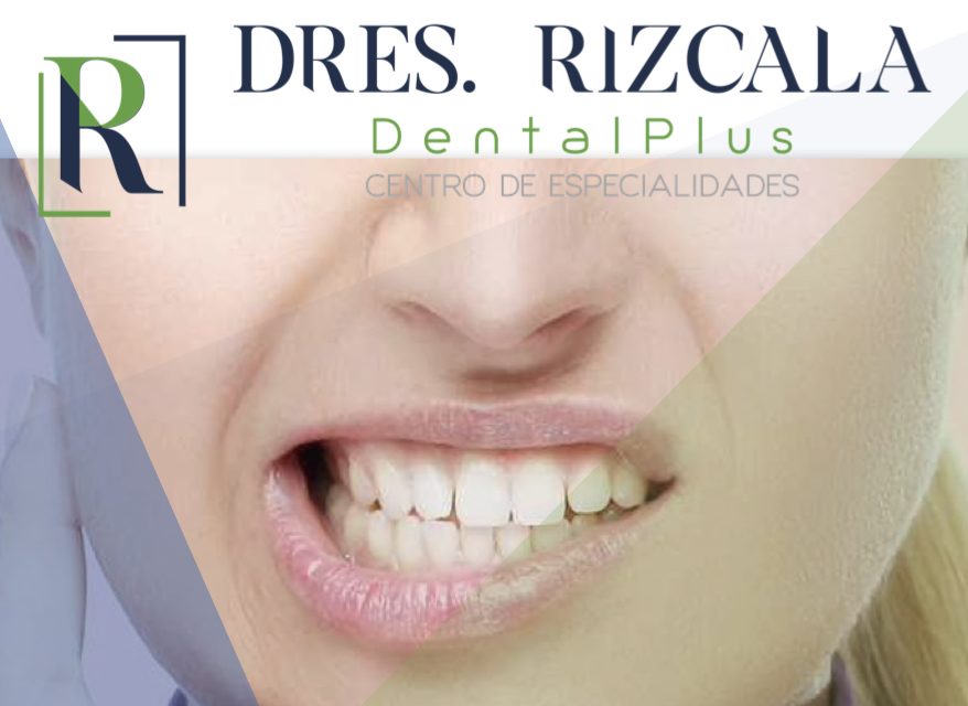 clinica dental Dentalplus